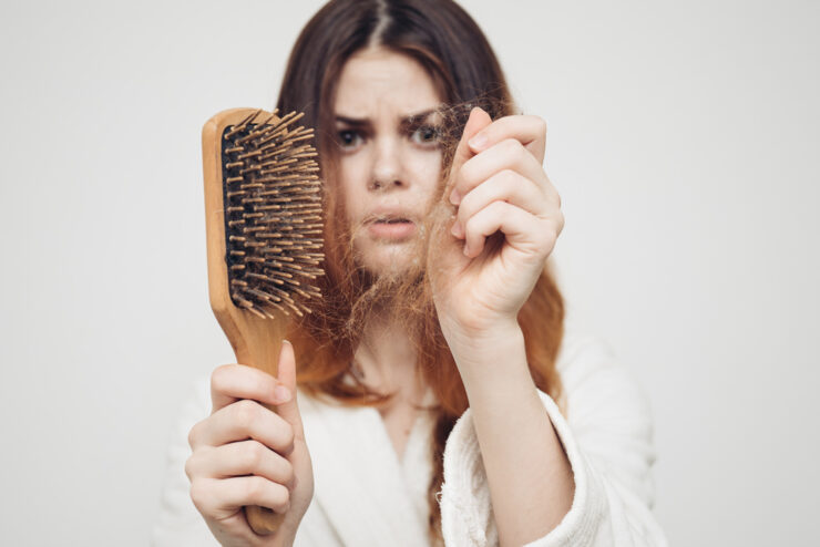 hair-loss-woman